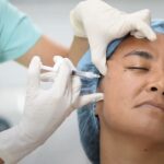 Bioestimuladores de colágeno pros y contras: 7 claves