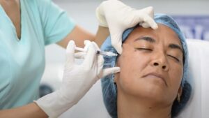 bioestimuladores colageno