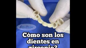 corona zirconio