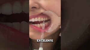 irrigador bucal