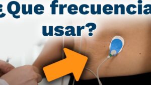 la electroestimulacion