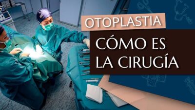 la otoplastia
