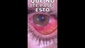 lentes contacto