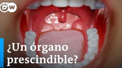 quitarse amigdalas