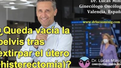 quitarse utero